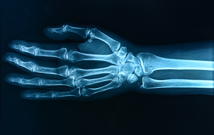 ThinkstockPhotos-507650587